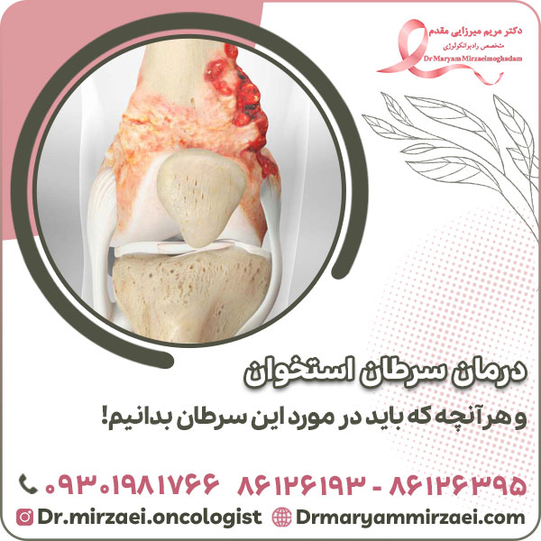 درمان سرطان استخوان و هرآنچه که باید در مورد این سرطان بدانیم!