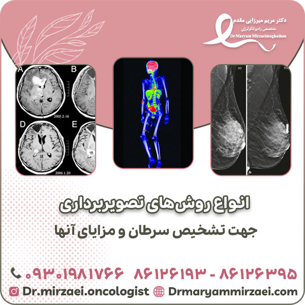 انواع روش های تصویربرداری جهت تشخیص سرطان و مزایای آنها