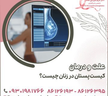 علت و درمان کیست پستان در زنان چیست؟