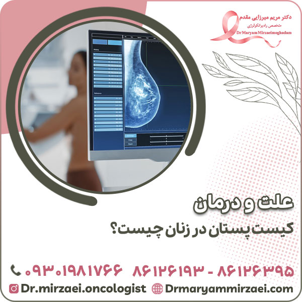 علت و درمان کیست پستان در زنان چیست؟