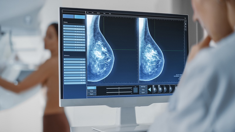 ماموگرافی پستان جهت تشخیص سرطان سینه