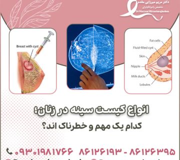 انواع کیست سینه در زنان؛ کدام یک مهم و خطرناک اند؟