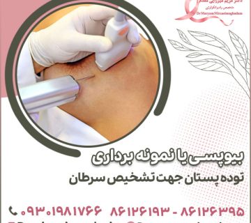 بیوپسی یا نمونه برداری توده پستان جهت تشخیص سرطان