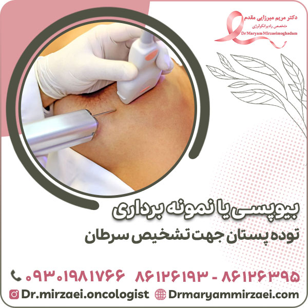 بیوپسی یا نمونه برداری توده پستان جهت تشخیص سرطان
