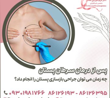 پس از درمان سرطان پستان چه زمان می توان جراحی بازسازی پستان را انجام داد؟