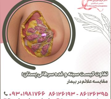 تفاوت کیست سینه و غده سرطانی پستان؛ مقایسه علائم در بیمار