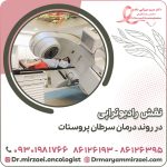نقش رادیوتراپی در روند درمان سرطان پروستات