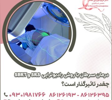 درمان سرطان با روش رادیوتراپی SRS و SBRT چقدر تاثیرگذار است؟