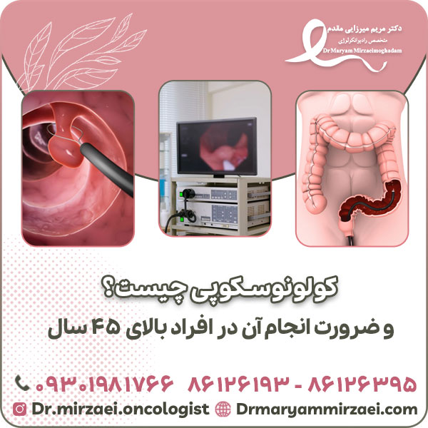 کولونوسکوپی چیست؟ و ضرورت انجام آن در افراد باالی 45 سال