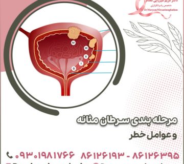 مرحله بندی سرطان مثانه و عوامل خطر