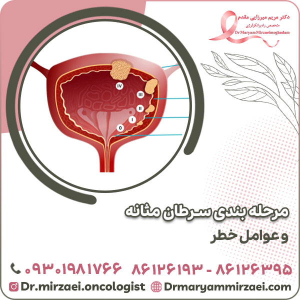 مرحله بندی سرطان مثانه و عوامل خطر