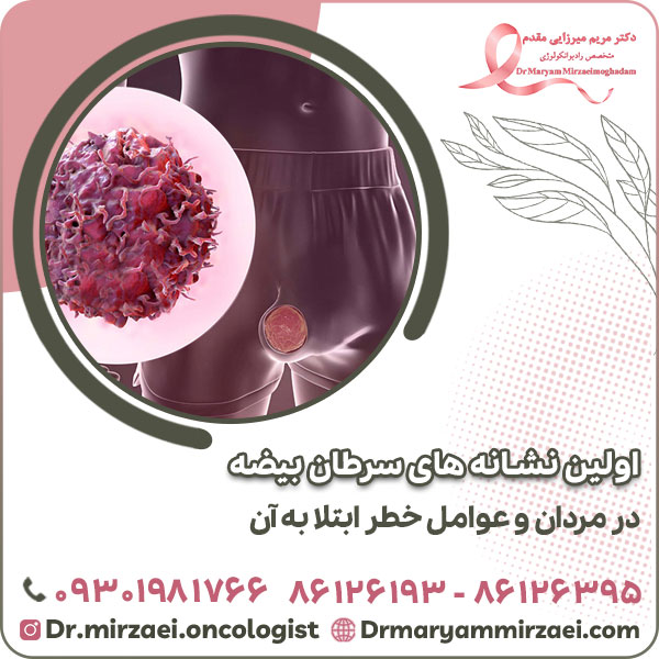 اولین نشانه های سرطان بیضه در مردان و عوامل خطر ابتلا به آن