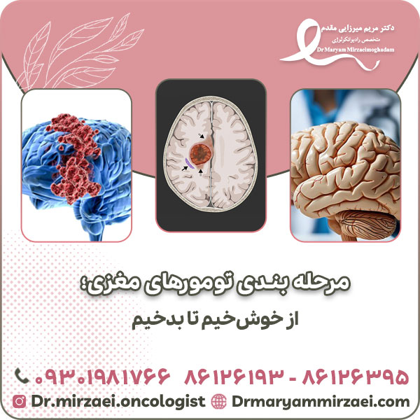مرحله بندی تومورهای مغزی؛ از خوش خیم تا بدخیم