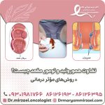تفاوت هموروئید و تومور مقعد چیست؟ + روش‌های مؤثر درمانی