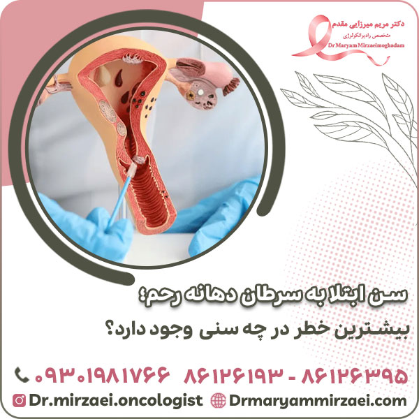 سن ابتلا به سرطان دهانه رحم؛ بیشترین خطر در چه سنی وجود دارد؟